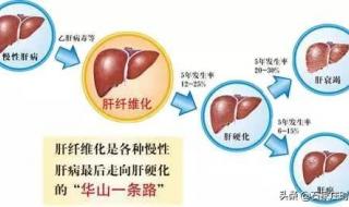 肝硬化最佳治疗方法