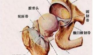 股骨头坏死早期症状